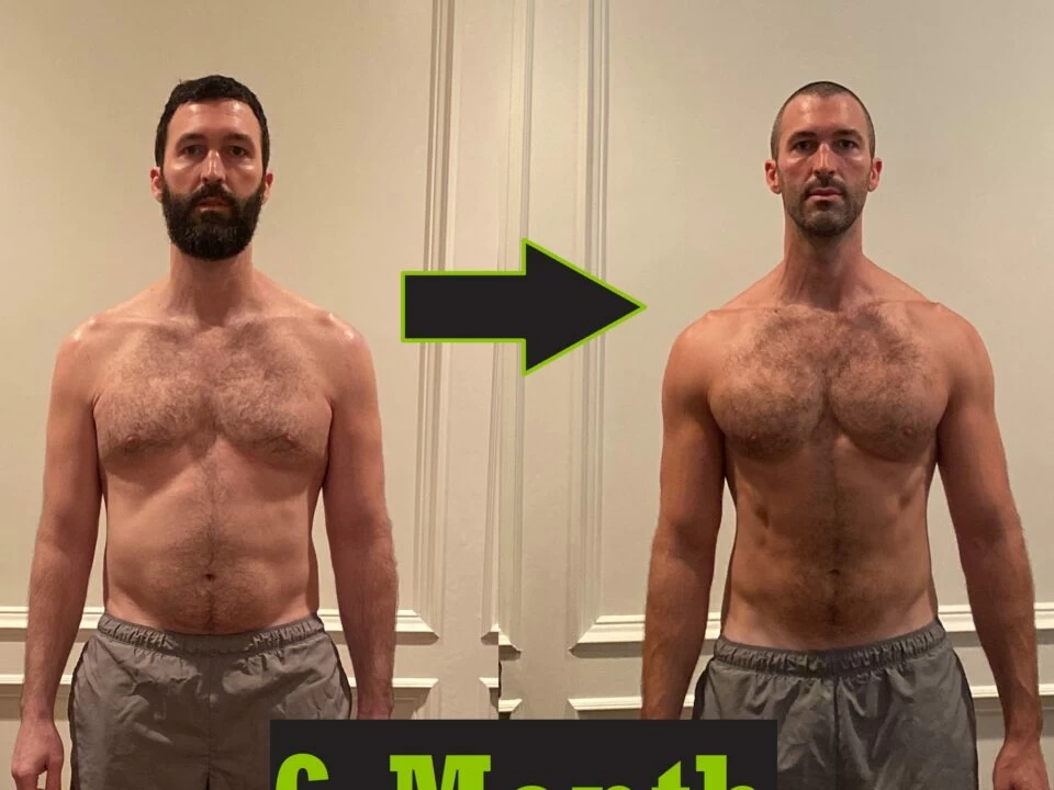 Before and After Shoulder Surgery